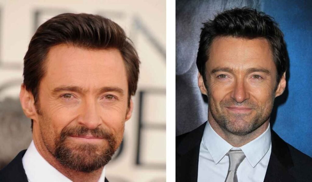 Hugh Jackman