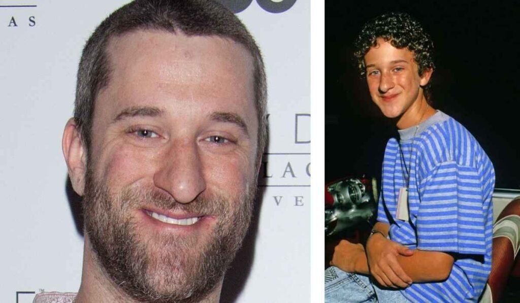 Dustin Diamond